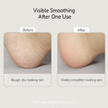 BUFFOUT Callus Eraser Exfoliating Gel – Body Care Exfoliator Scrub & Exfoliant for Feet, Heels, Elbows & Knees – Dead Skin Care with Perlite & Apricot Seed Powder