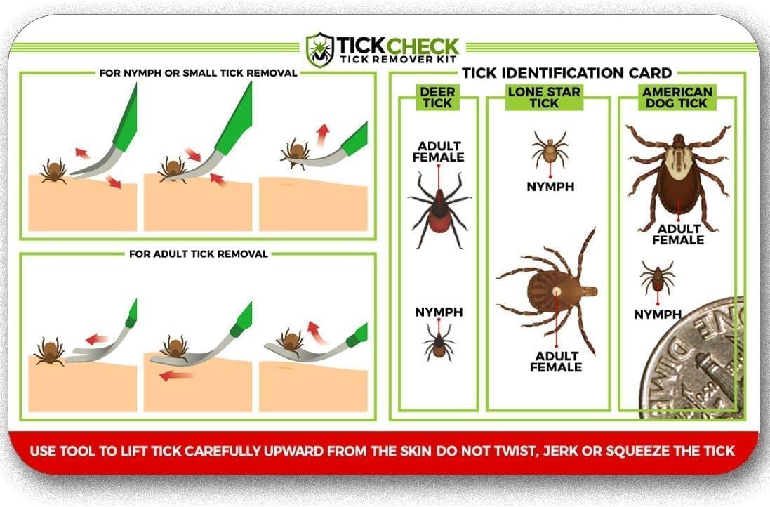 Premium Tick Remover Kit - Stainless Steel Tick Remover + Tweezers, Leather Case, and Free Pocket Tick Identification Card (1 Set)
