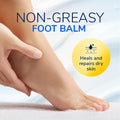 Dr. Scholl's Severe Cracked Heel Repair Restoring Balm 2.5oz, with 25% Urea for Dry, Cracked Feet, Heals and Moisturizes for Healthy Feet, Epsom Salt Soothes, Safe for Diabetics, 3-pack