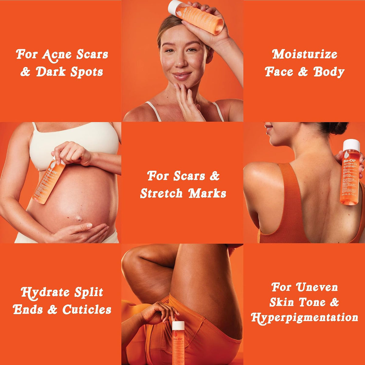 Bio-Oil Skincare Body Oil Serum, Scars & Stretch Marks, 4.2 fl oz | Dermatologist Recommended, Vitamin E & A, Dry & Sensitive Skin, Non-Comedogenic, Face and Body, Scar Treatment