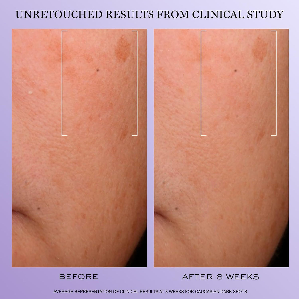 Lancôme Rénergie H.C.F. Triple Serum - Hyaluronic Acid Anti Aging Serum