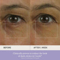 TATCHA The Brightening Eye Cream, Dark Circle Reduction with Vitamin C