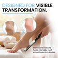 Colossal Foot rasp Foot File and Callus Remover. Best Foot Care Pedicure Metal Surface Tool to Remove Hard Skin. Can be Used on Both Wet and Dry feet, High Grade Stainless Steel File
