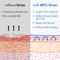 Ebanel Urea Cream 40% plus Salicylic Acid 2% for Dry Cracked Feet Skin | Deeply Moisturizes & Softens Dry Cracked Heels, Feet, Knees, Elbows, Hands, Rough Dead Skin Callus Remover Toenail Softener