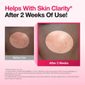 Why the Anua Niacinamide 10 + TXA 4 Serum might become your new daily skin BFF