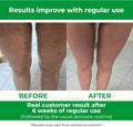 TESMED Cellulite Manual Massager Roller for Thighs and Buttocks | Made in Italy and patented, with converging and diverging roller technology for targeted anti-cellulite massage.