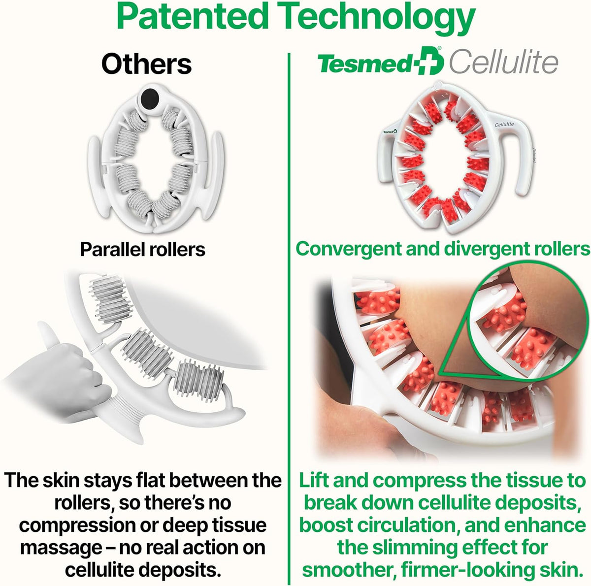 TESMED Cellulite Manual Massager Roller for Thighs and Buttocks | Made in Italy and patented, with converging and diverging roller technology for targeted anti-cellulite massage.
