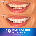 Crest Teeth Whitening Strips, Crest 3D Whitestrips Professional Effects, Enamel Safe Teeth Whitening Kit, 22 Treatments (44 Strips), Professional-Level Whitening, 19 Levels Whiter