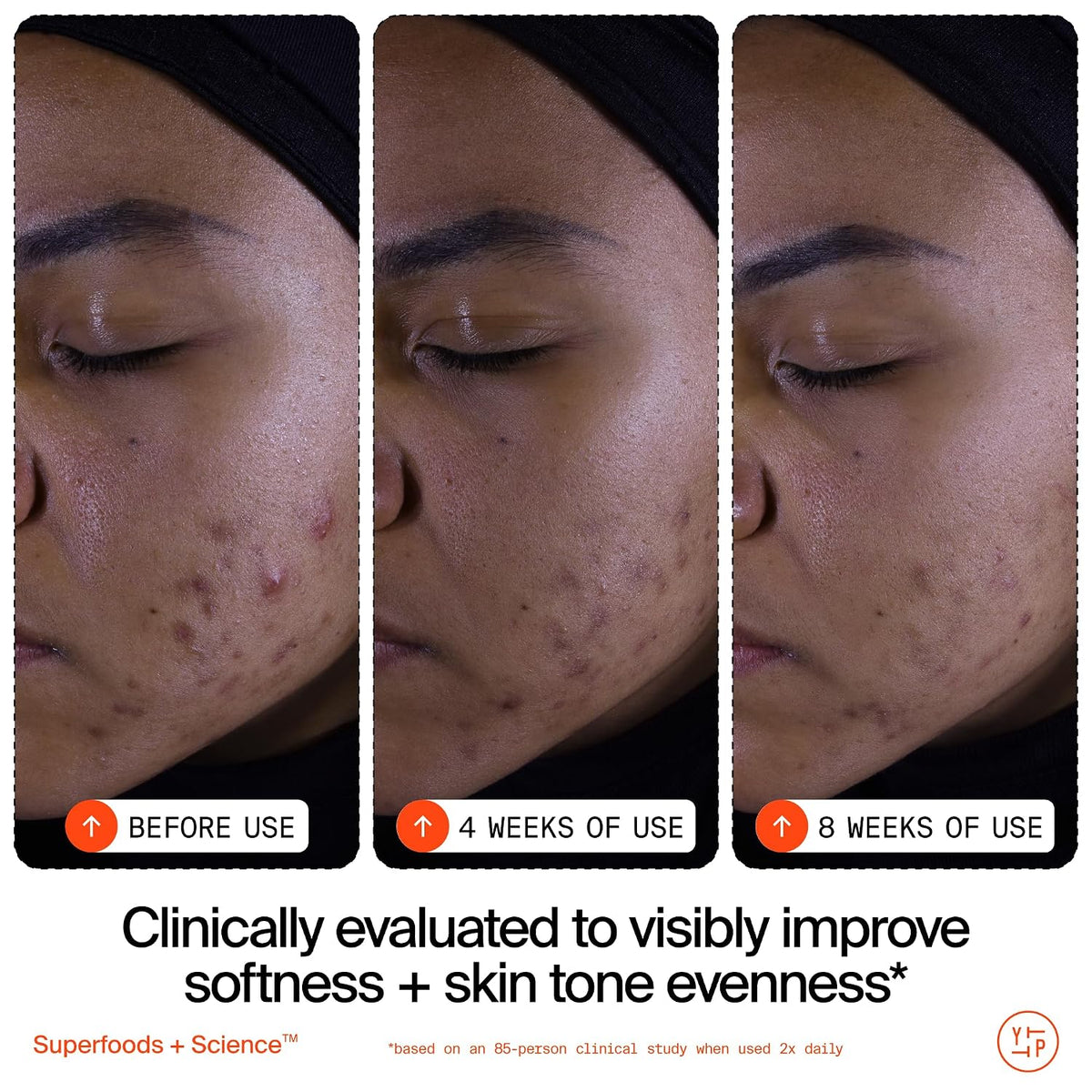 Youth To The People Superfruit Facial Cleanser - Papaya + Vitamin C Gentle Exfoliating Face Wash, Cellular Skin Renewal with AHA + BHA, Evens Skin Tone & Texture for Soft + Radiant Skin, Sulfate-free