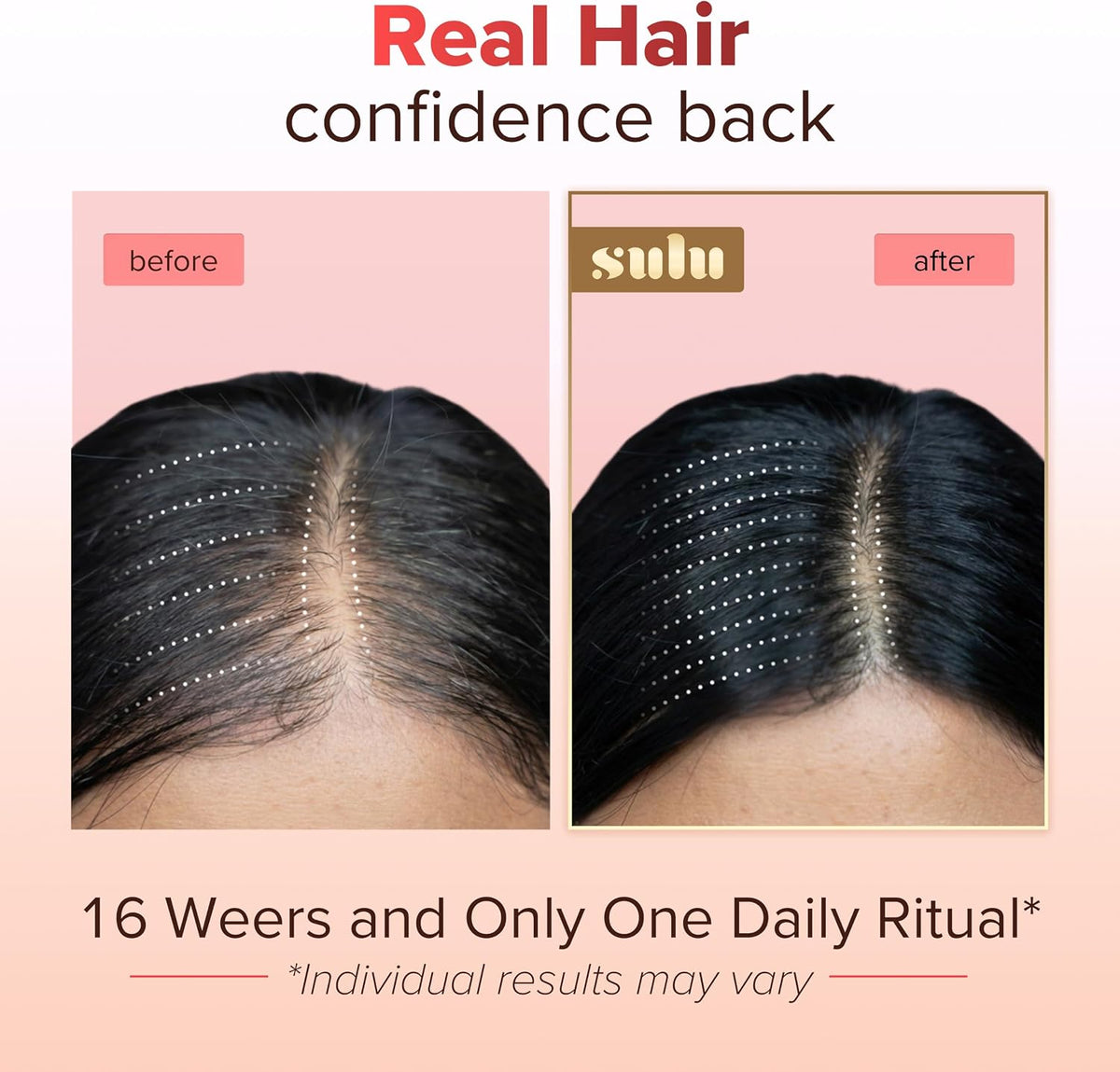SULU Hair Growth Gummies - Biotin Supplements for Women Skin Nails Vitamins