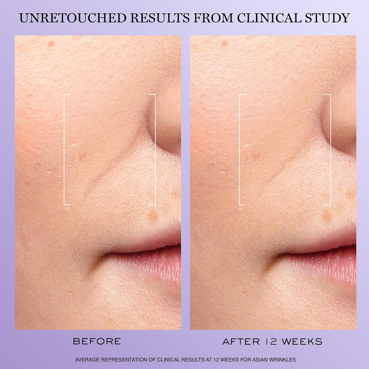 Lancôme Rénergie H.C.F. Triple Serum - Hyaluronic Acid Anti Aging Serum