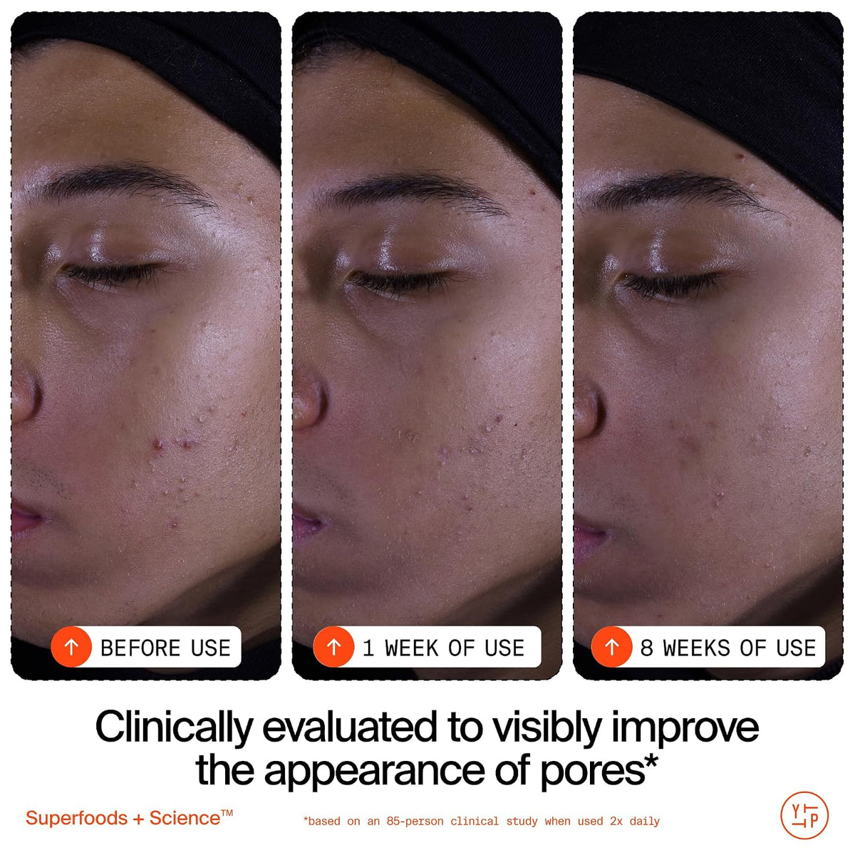 Youth To The People Superfruit Facial Cleanser - Papaya + Vitamin C Gentle Exfoliating Face Wash, Cellular Skin Renewal with AHA + BHA, Evens Skin Tone & Texture for Soft + Radiant Skin, Sulfate-free