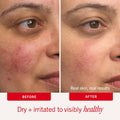 First Aid Beauty Ultra Repair Cream, Intense Hydration - Clinically Tested Face & Body Moisturizer with Colloidal Oatmeal - Supports Eczema & Dry Skin Barrier Repair - Fragrance Free