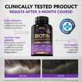 Biotin | Collagen | Hyaluronic Acid | Keratin - Hair Growth & Strength Support Vitamins - Skin & Nails Supplement - Clinically Tested for Men & Women - 25000mcg Vitamins B1, B2, B3, B6 & B7 - 60 Caps