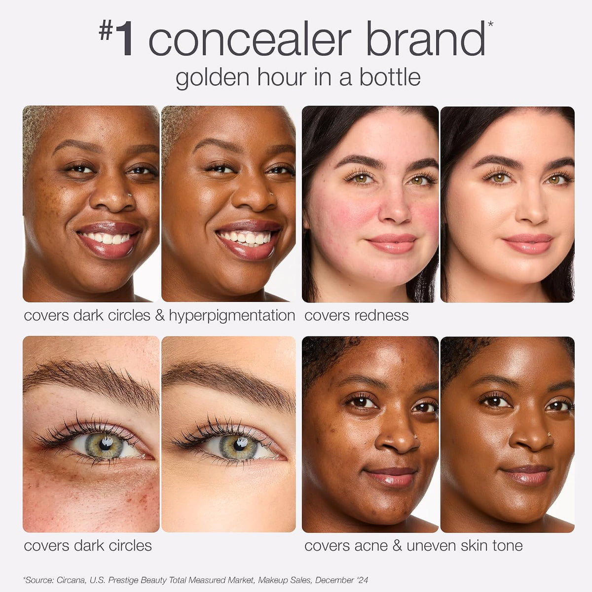tarte shape tape radiant concealer – Medium-Coverage, Radiant Finish for Under Eye Concealer for Dark Circles, Fine Lines, Redness & Discoloration, Hydrating, Vegan, Cruelty Free