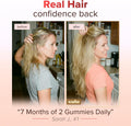 SULU Hair Growth Gummies - Biotin Supplements for Women Skin Nails Vitamins