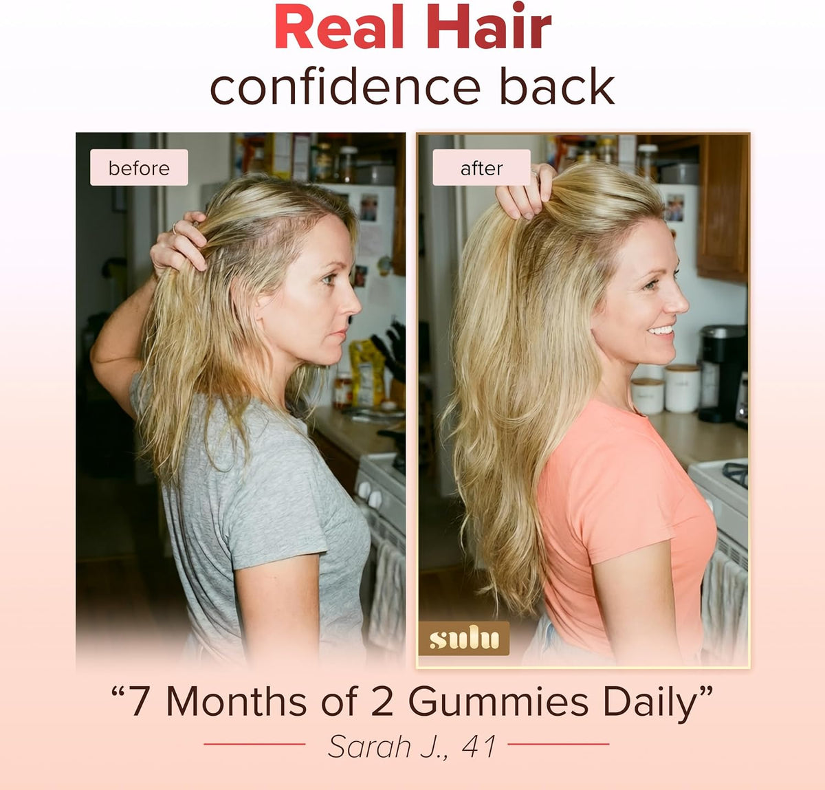 SULU Hair Growth Gummies - Biotin Supplements for Women Skin Nails Vitamins